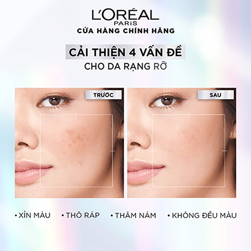 tinh_chat_tri_nam_loreal